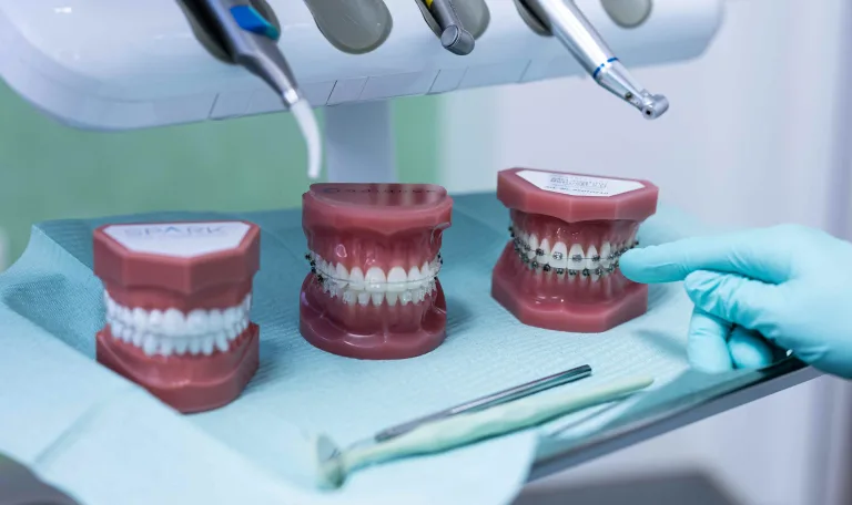 ortodontie-preventie-acasa